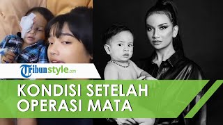 Gala Sky Ardiansyah Jalani Operasi Mata dan Tak Ada Kendala Fisik, Kini dalam Masa Pemulihan