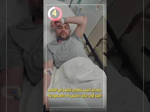 حسام حبيب يتعرض لكسر فى القدم قبل أول حفل رسمى له بالسعودية