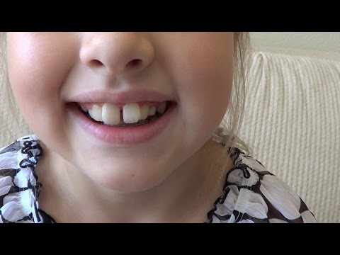 GABRIELLE GETS BRACES | EPISODE 3 Video