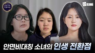 열아홉 소녀의 '새로운 삶의 시작'을 응원해주세요👏｜일퍼센트성형외과