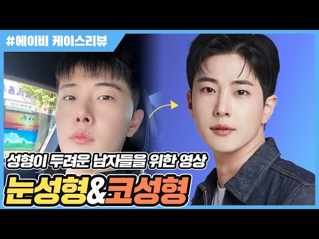 코재수술비용 합리적인 5