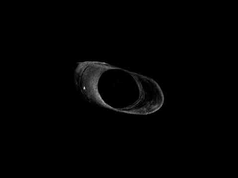 Forest Drive West | STVVV [Kynant 2019]