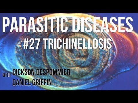 trichinosis tünetei