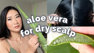 Aloe Vera Scalp Treatment | Treat dry scalp + dandruff