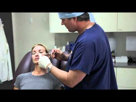 download lagu mp3 mp4 Filler Perth, download lagu Filler Perth gratis, unduh video klip Filler Perth