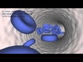 Deep Vein Thrombosis