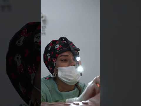 Rhinoplasty Surgery Walkthrough