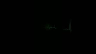 Download lagu Story Wa Paling Sedih // Selamat Jalan // Kematian #shortsfeed #quote #religion #story #love #Sedih mp3