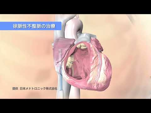 国際医療福祉大学病院　心臓ひとくちアドバイス第5回関連動画／突然死を防ぐ