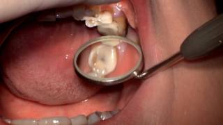 Dental treatment plan for a patient