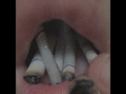 NIKKO - PEST (Prod. Kiraw)