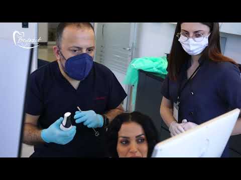 Dental Clinic Promotion | Dental Aesthetic Turkey