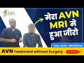 Bilateral AVN hip joint recovery - AVN treatment without Surgery - Avn reverse without surgery