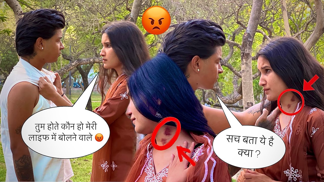 Love Bite Prank 😡💋| Aaryan Singh | Kashish