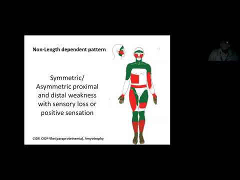 Approach to Peripheral neuropathy- Dr Ajith Sivadasan