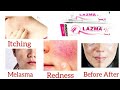 Lazma Cream uses for skin