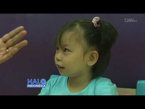 Watch lagu Images Videos Cerebral Palsy In Indonesia, Watch Images Cerebral Palsy In Indonesia free Watchn, video klip Cerebral Palsy In Indonesia