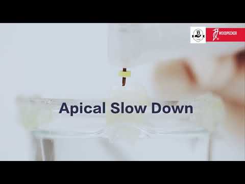 Woodpecker Endo Motor and apex locator operation demonstration