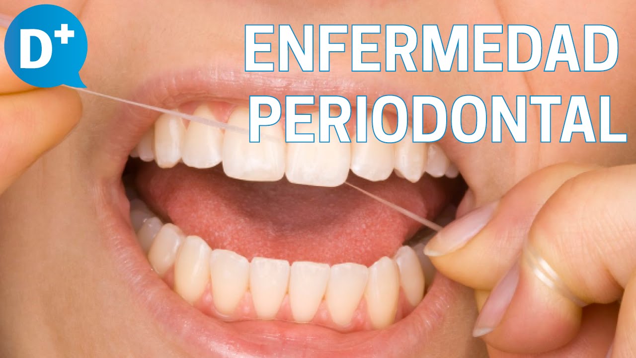 Tratamiento de la enfermedad periodontal