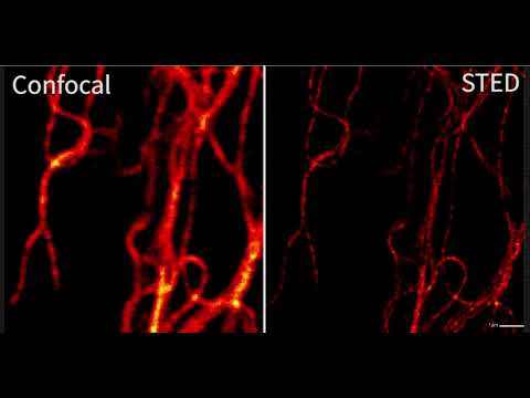 Конфокальные и STED изображения. 1.5 часа съемки (100 кадров) - 1 область