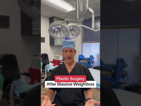 Plastic Surgery After Massive Weight Loss w/ Dr. Rock-It! ????