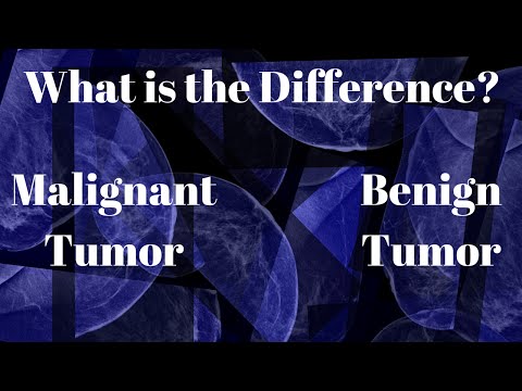 What Is the Difference between a Benign and Malignant Tumor?