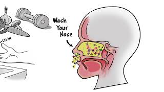 A Medical Breakthrough - Wash Your Nose