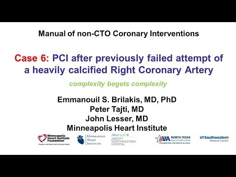 Case 6: PCI Manual - Severe calcification and distal vessel perforation