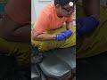 Chiropractic Treatment For Back Pain Drrajneeshkant Rkm World Famous Chiropractor