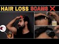Worst Hair Loss SCAMS NATURALLY Regrow Teenage Hair Loss Hair Fall Hair Thinning Indian Hair