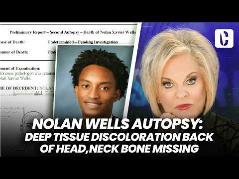 NOLAN WELLS AUTOPSY: DEEP TISSUE DISCOLORATION BACK OF HEAD, NECK BONE MISSING