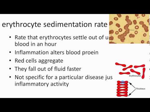 PATHOPHYSIOLOGY essentials EXPLAINED Cardiovascular 4a of 5 anemia