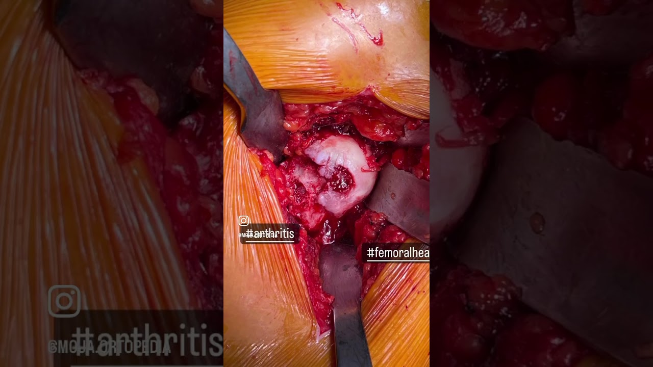 Krzysztof Miśkowiec-4