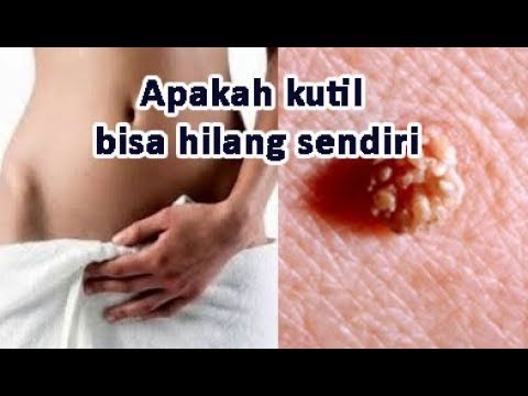 Orang sebagai benar-benar memperbesar penis Anda Merangsang obat wanita