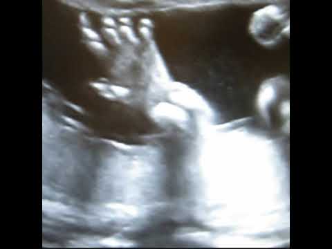 planet uterus - life (traumprinz)