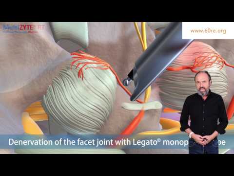 Behandlung von Erkrankungen der Gelenke Ankle Lock fs 2202