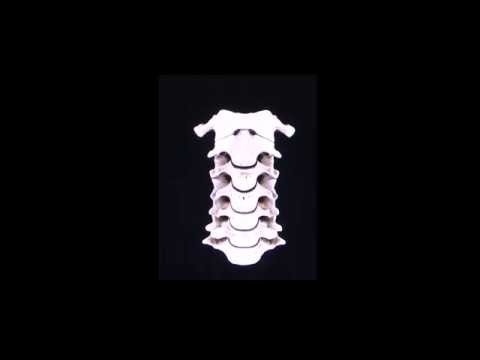 Il riscaldamento con il mal di schiena Osteocondrosi Mydocalmum del rachide cervicale