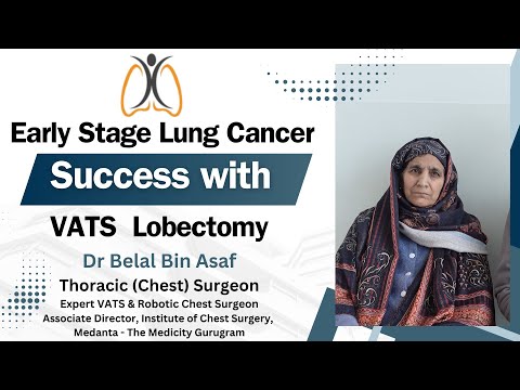 "Early-Stage Lung Cancer Success | VATS Lobectomy Journey | Patient Family Shares Experience"