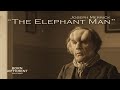 The Elephant Man: The Real Story of Joseph Merrick | Born Different: Real Stories#BornDifferent