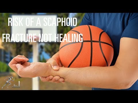 What's the risk if a scaphoid fracture didn't heal?