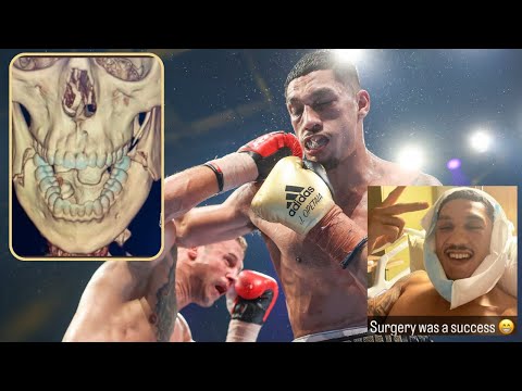 Jai Opetaia OUT A Year? | Jaw Broken BOTH SIDES In Briedis WIN | EASY Touch OR Unification Return?