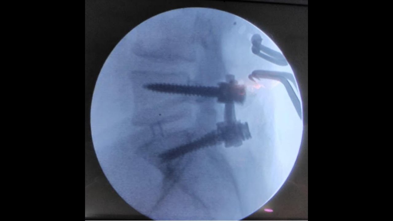 Federico Ramírez Castañeda-60