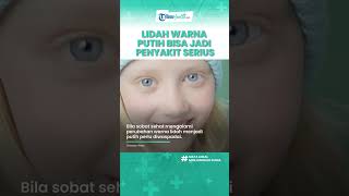 Waspadai Lidah Warna Putih Bisa Jadi Tanda Penyakit Serius, Infeksi Jamur & Leukoplakia