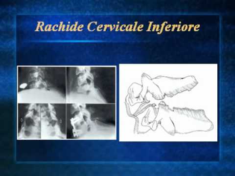 Biomeccanica del ginocchio Mal di addome dà la schiena e giallo scarico