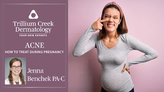 How to treat acne during pregnancy.