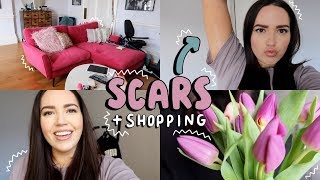 Scars, A HUGE Food Shop + Selling All My Furniture 😩