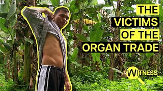 Organ Thieves: Inside the Dark World of Organ Trafficking | Organ Trade Documentary