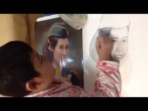 ลดลงเพิ่มขึ้นแรงในยูเครน ทรายในไตแรง