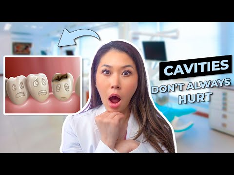 Cavities in Teeth and What to Expect at the Dentist