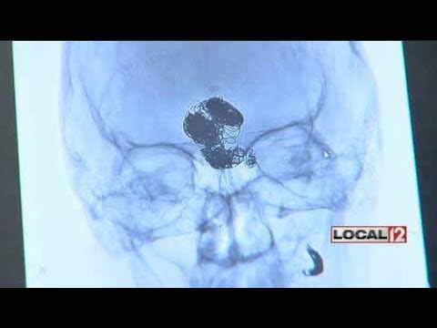 Brain Aneurysm 3K Mini Walk & Fair raises awareness, funds for support group